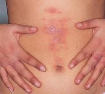 Dr. Palikóné, Dr. Pétervári Márta Bőrgyógyász-Kozmetológus kép