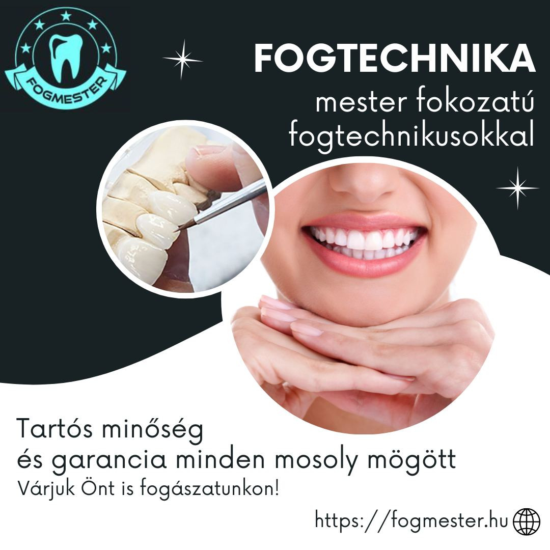 Fogmester fogászat kép