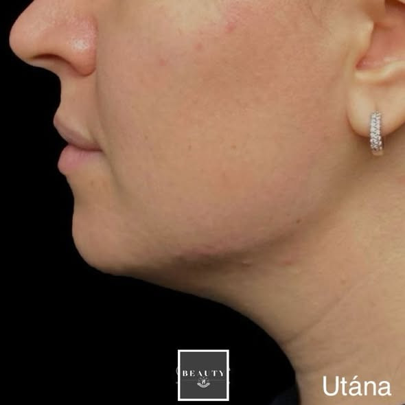 Fogmester Beauty Botox Budaörs kép