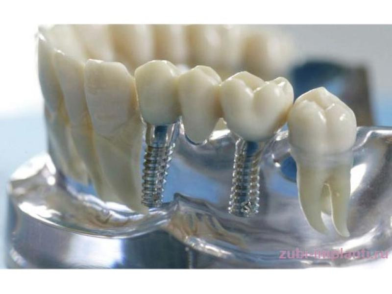 GB Dental fogászati és fogszabályozási szakrendelő Pápa kép