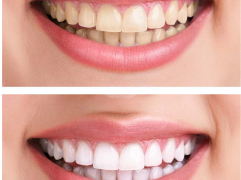 GB Dental fogászati és fogszabályozási szakrendelő Pápa kép