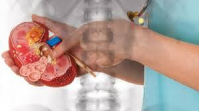 Dr. med. habil Gervain Mihály urológus, nephrológus és sebész főorvos kép