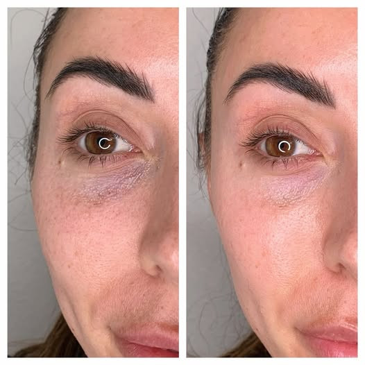 Fogmester Beauty Botox Budaörs kép
