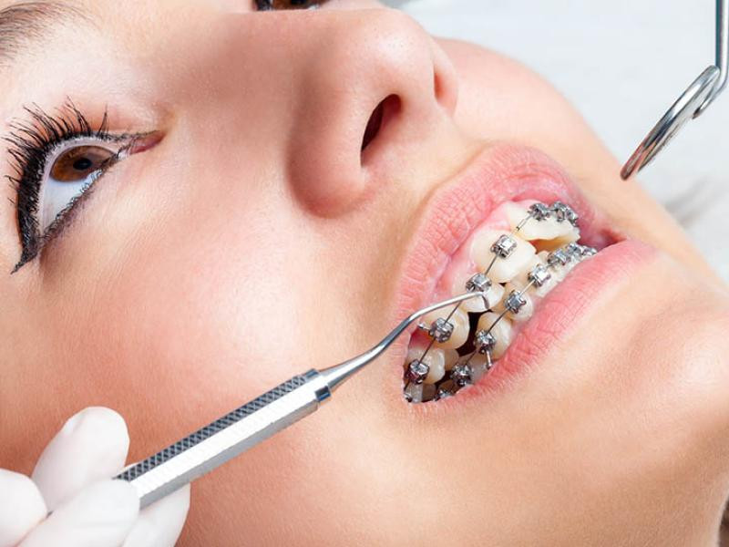 GB Dental fogászati és fogszabályozási szakrendelő Pápa kép